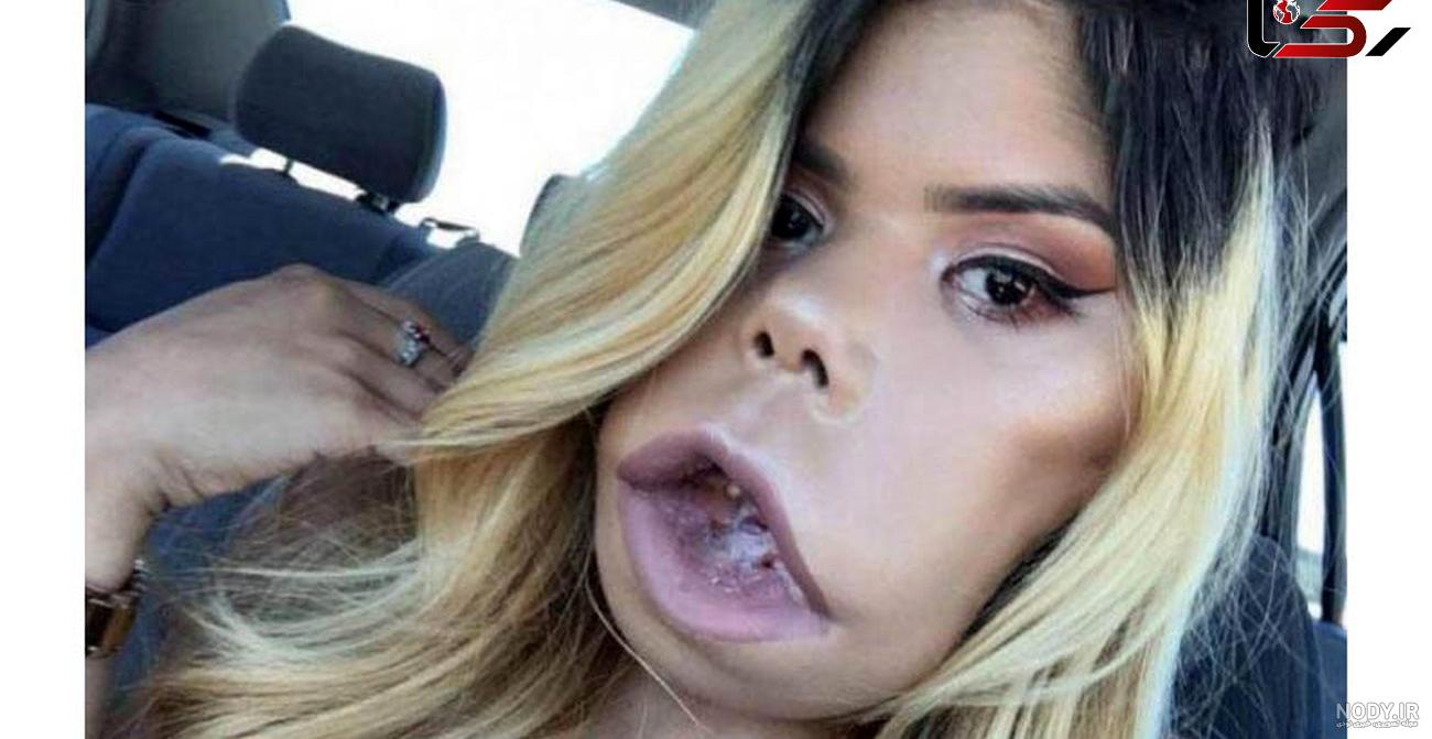 عکس دختر لاغر و زشت عکس دختر لاغر و زشت