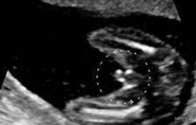 عکس خفن عکس سونوگرافی پسر