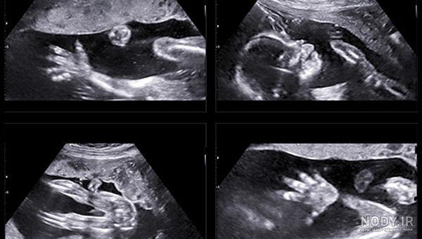 عکس خفن عکس سونوگرافی پسر