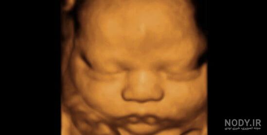 عکس خفن عکس سونوگرافی پسر