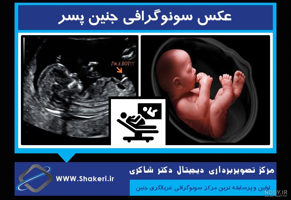 عکس خفن عکس سونوگرافی پسر