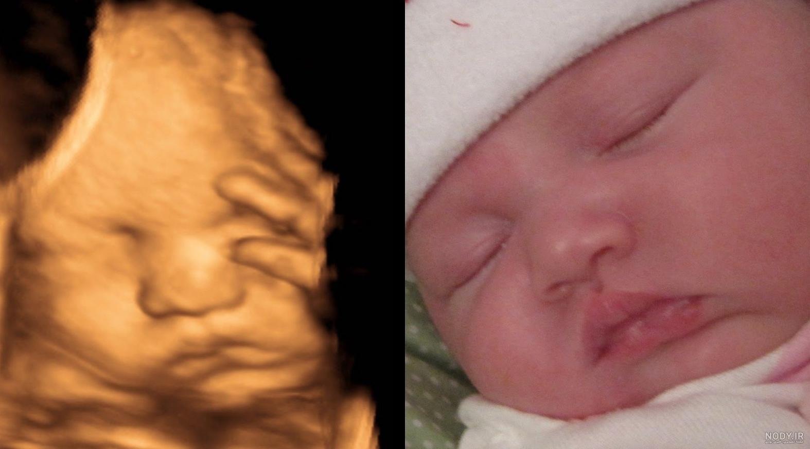 عکس برگه سونوگرافی جنین دختر