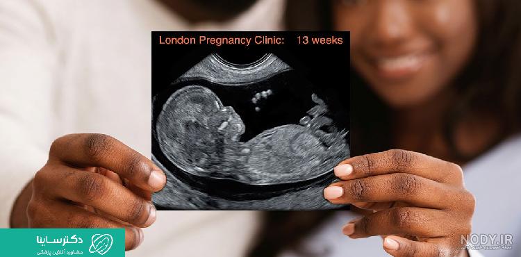 عکس خفن عکس سونوگرافی پسر