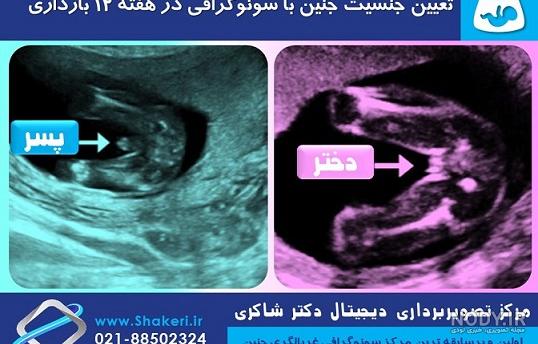 عکس برگه سونوگرافی جنین دختر