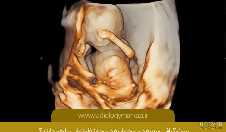 عکس برگه سونوگرافی جنین دختر