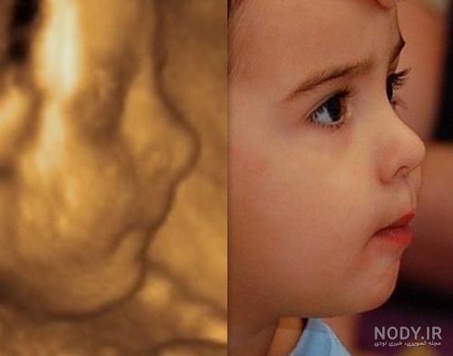 عکس خفن عکس سونوگرافی پسر