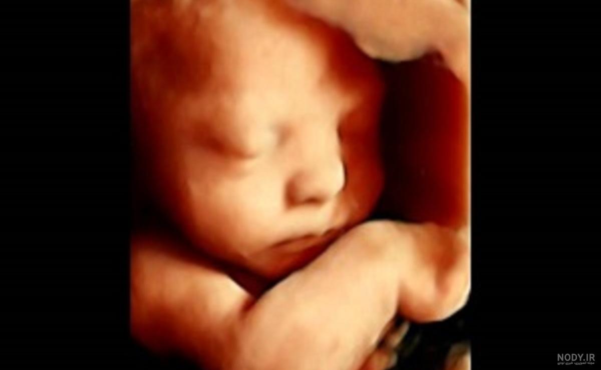 عکس سونوگرافی پسر