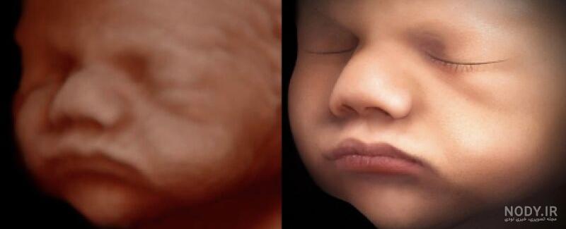 عکس برگه سونوگرافی جنین دختر