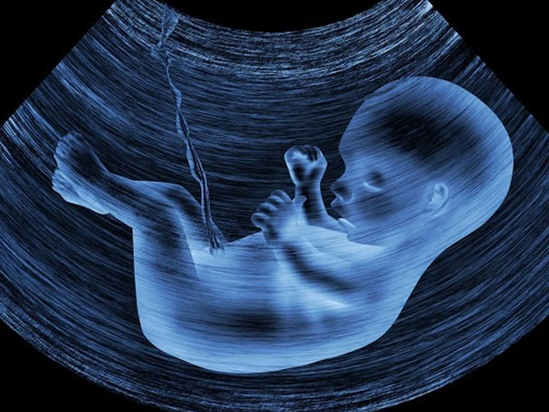 عکس خفن عکس سونوگرافی پسر