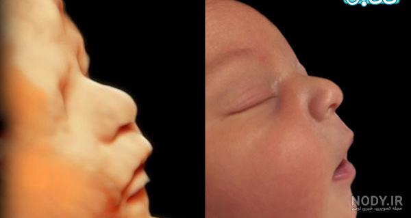 عکس خفن عکس سونوگرافی پسر