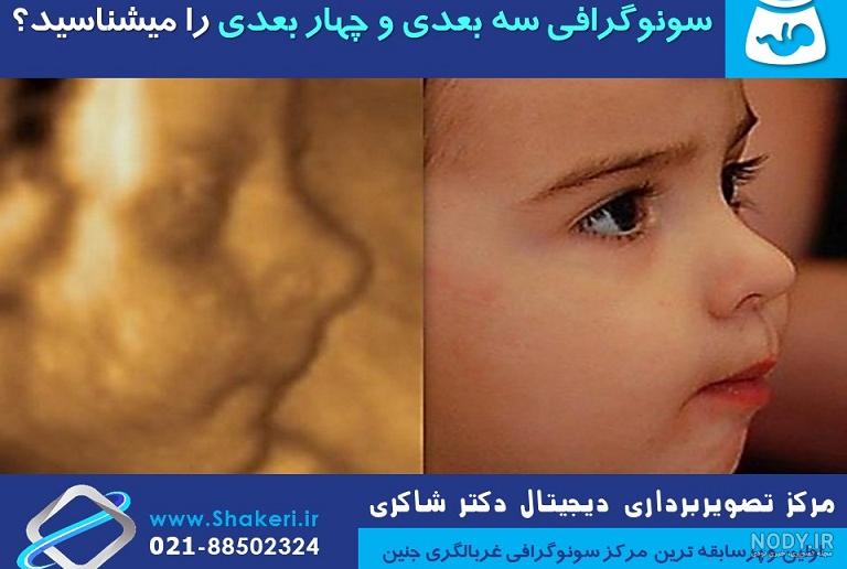 عکس برگه سونوگرافی جنین دختر