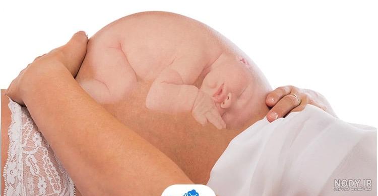 عکس برگه سونوگرافی جنین دختر