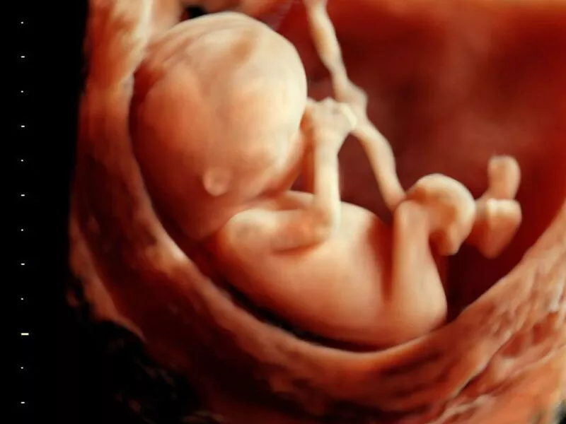 عکس خفن عکس سونوگرافی پسر