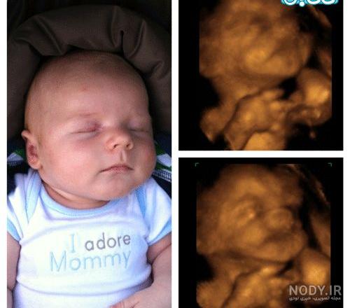 عکس برگه سونوگرافی جنین دختر