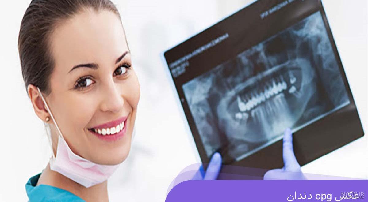 CBCT - راديولوژي تخصصي دهان ، فک و صورت رايان پرتو ( دکتر سحر محمدي) CBCT - راديولوژي تخصصي دهان ، فک و صورت رايان پرتو ( دکتر سحر محمدي)