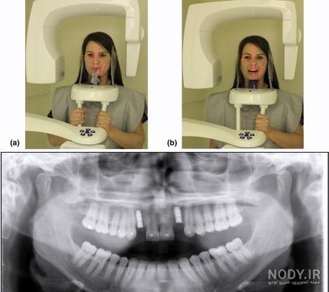 اسکن سه بعدی یا CBCT - اول دنت اسکن سه بعدی یا CBCT - اول دنت