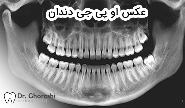 امکان تهیه مدل مجازی سه‌بعدی فک از تصاویر OPG – دندانه | پایگاه خبری  الکترونیک