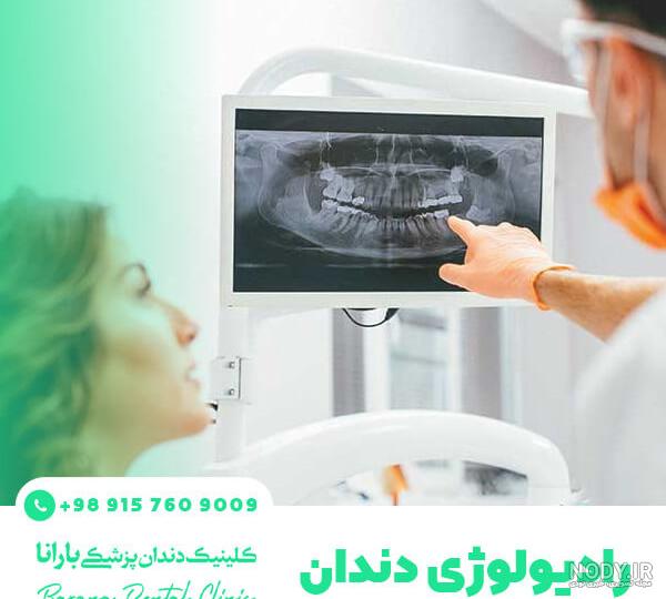 تفاوت opg و cbct | نوبت دهی آنلاین | رادیولوژی دندان بوشهری تفاوت opg و cbct | نوبت دهی آنلاین | رادیولوژی دندان بوشهری