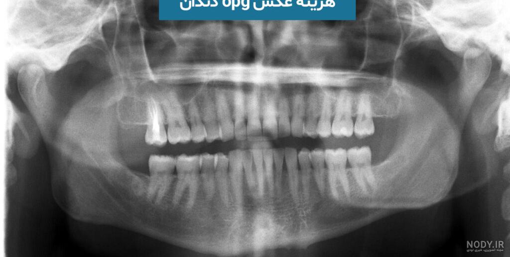 سونوگرافی الوند سونوگرافی الوند