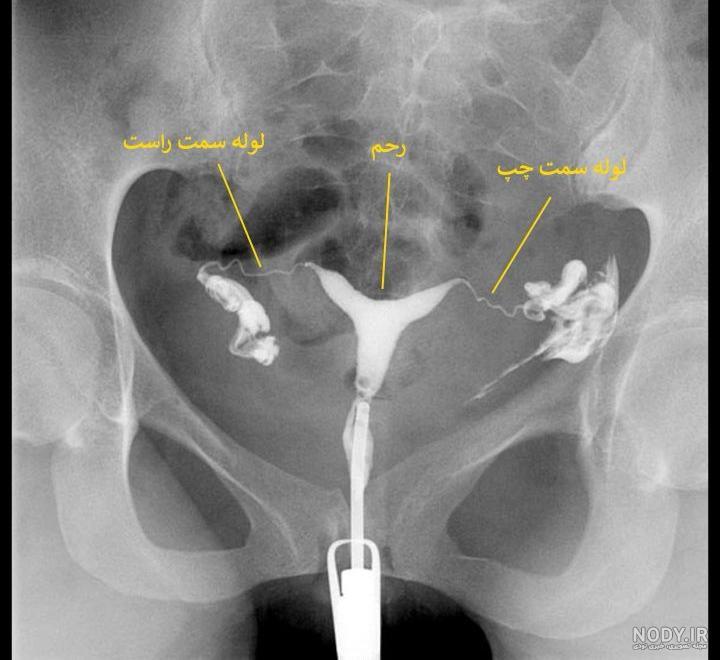 سونوگرافی سه بعدی رحم ترنس واژینال و ابدومینال - سونوگرافی رسا سونوگرافی سه بعدی رحم ترنس واژینال و ابدومینال - سونوگرافی رسا