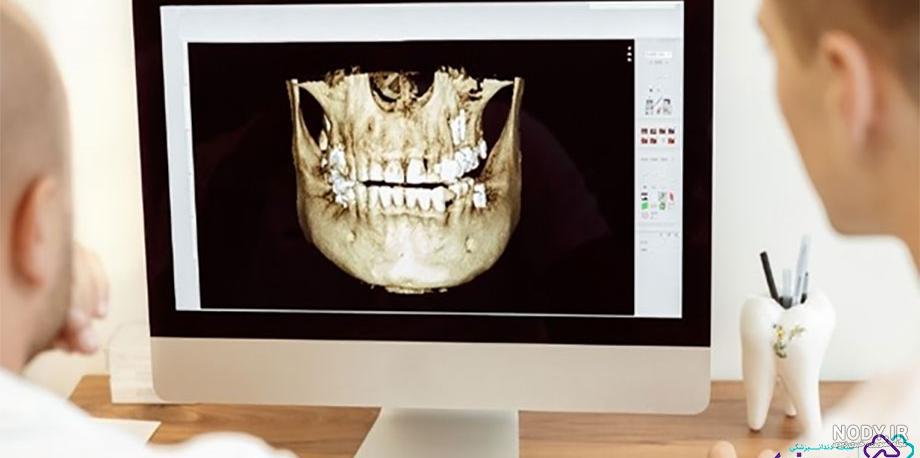 عکس استوک دندان و دندان پزشکی سه بعدی - Treatment of tooth 3d - ایران جی اف ایکس عکس استوک دندان و دندان پزشکی سه بعدی - Treatment of tooth 3d - ایران جی اف ایکس