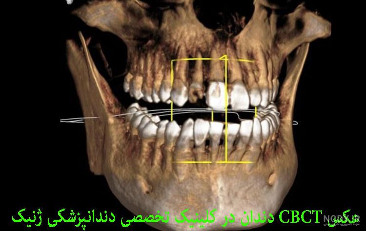 عکس CBCT چه کاربردی دارد ؟ | دکتر پیام حیاتی - دندانپزشک عکس CBCT چه کاربردی دارد ؟ | دکتر پیام حیاتی - دندانپزشک