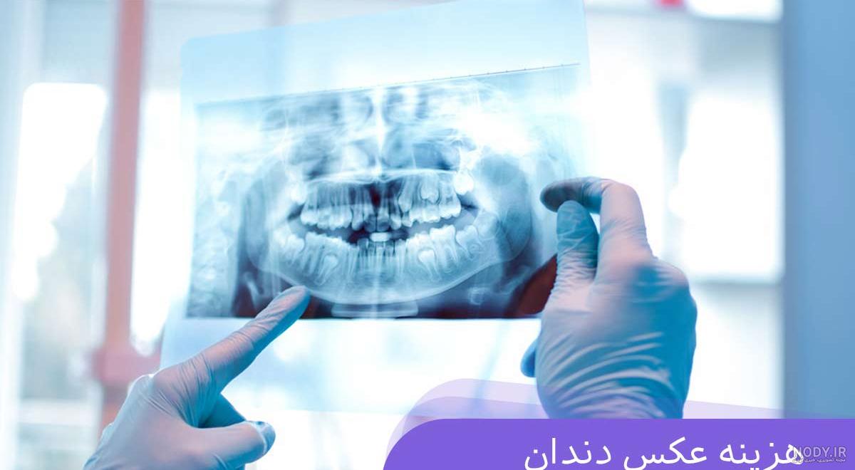 عکس cbct چیست| هزینه عکس cbct دندان ۱۴۰۳ عکس cbct چیست| هزینه عکس cbct دندان ۱۴۰۳