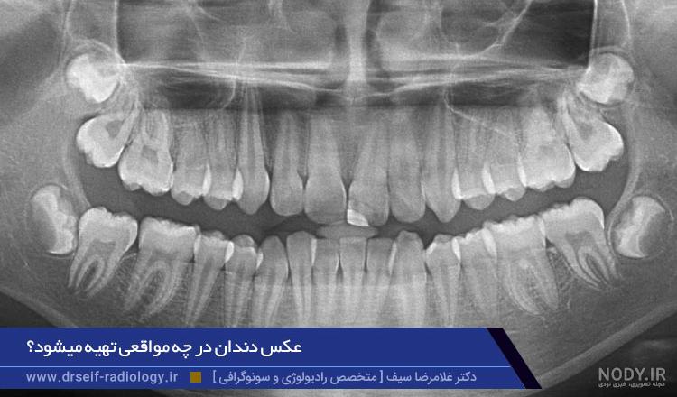عکس cbct چیست| هزینه عکس cbct دندان ۱۴۰۳ عکس cbct چیست| هزینه عکس cbct دندان ۱۴۰۳