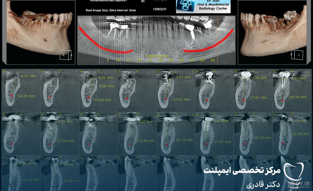 عکس cbct چیست| هزینه عکس cbct دندان ۱۴۰۳ عکس cbct چیست| هزینه عکس cbct دندان ۱۴۰۳