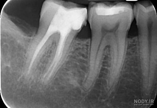 هزینه عکس دندان (OPG و CBCT) در سال 1403 چقدر است؟ - دندانپزشکی شبانه روزی تاج هزینه عکس دندان (OPG و CBCT) در سال 1403 چقدر است؟ - دندانپزشکی شبانه روزی تاج