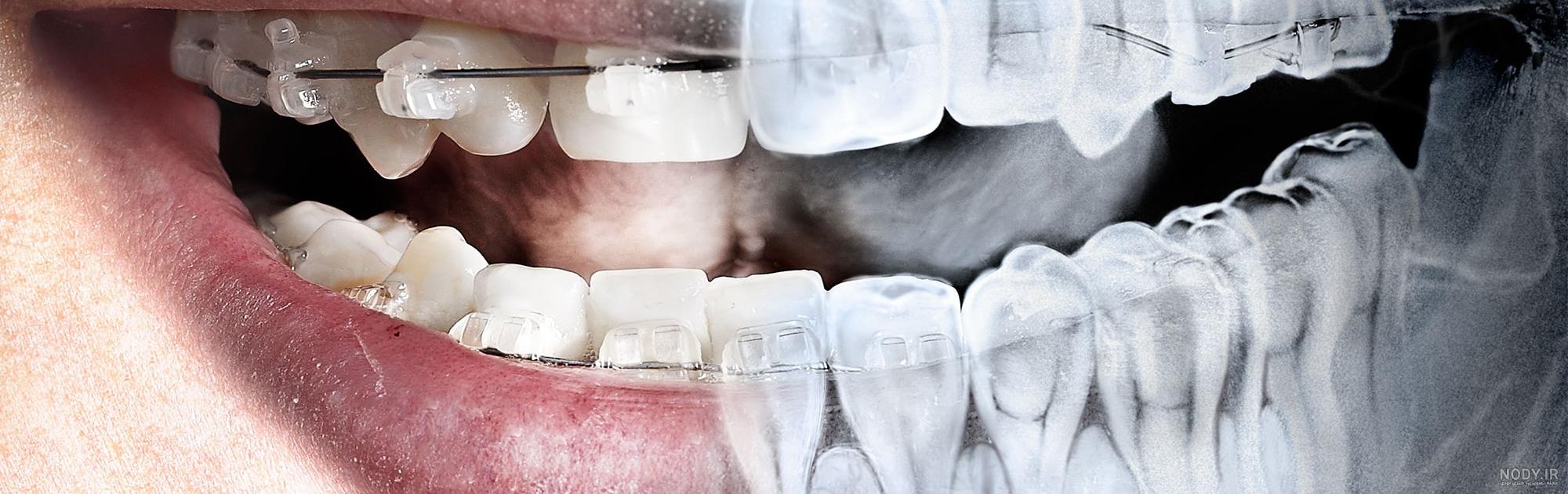 هزینه عکس opg دندان در سال 1403 چقدر است؟ - bestdentists هزینه عکس opg دندان در سال 1403 چقدر است؟ - bestdentists