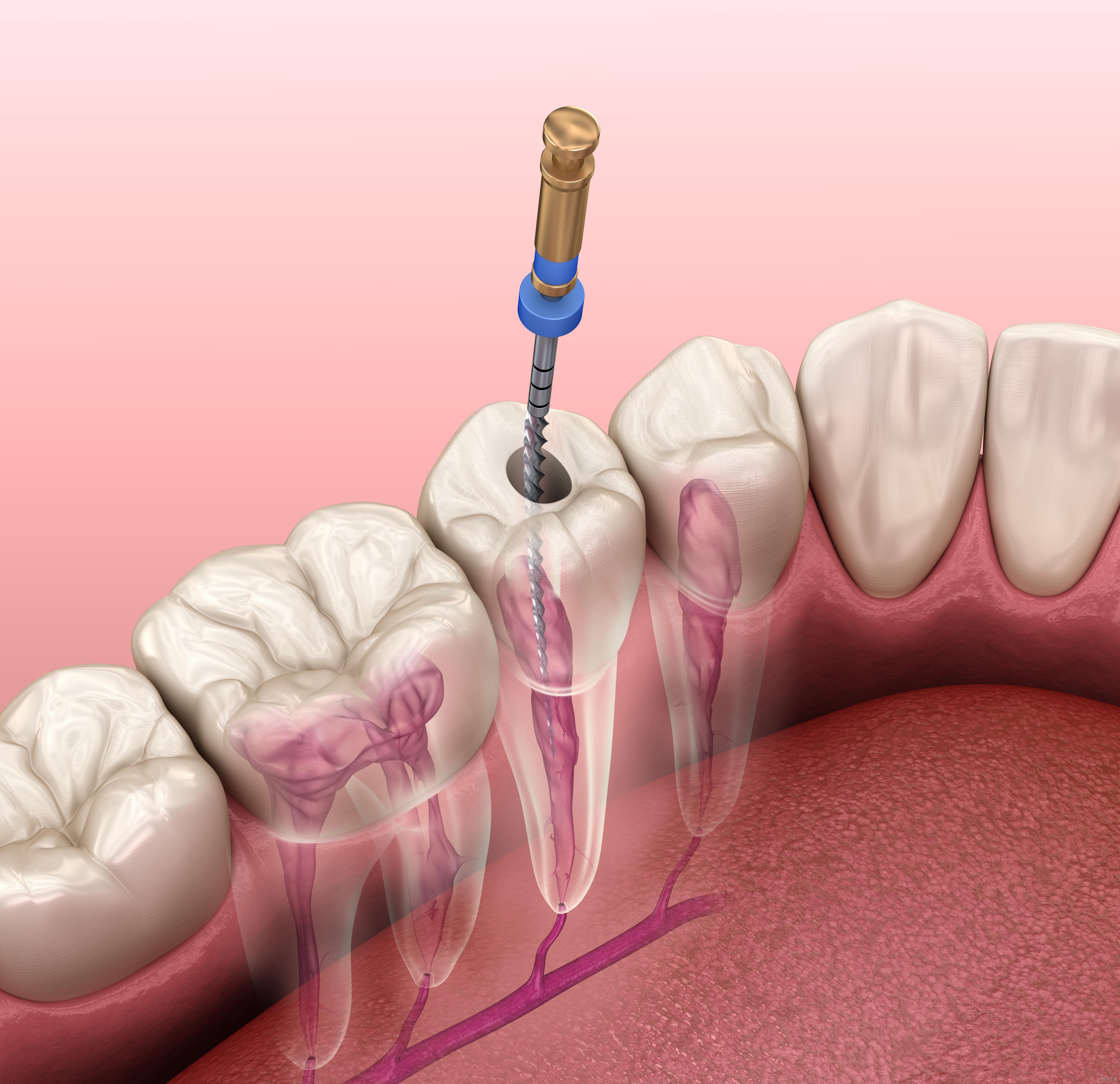 هزینه عکس CBCT دندان در سال 1402چقدر است؟ | کلینک تخصصی ژنیک هزینه عکس CBCT دندان در سال 1402چقدر است؟ | کلینک تخصصی ژنیک
