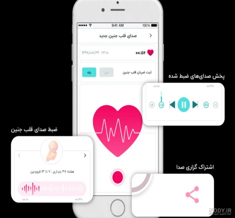 گاهی باید از جنین نوار قلب گرفت