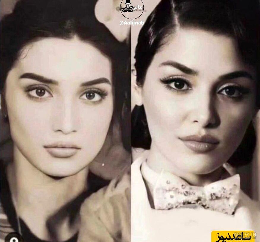 بیوگرافی هانده ارچل + عکس قبل و بعد از عمل و زندگی خصوصی او بیوگرافی هانده ارچل + عکس قبل و بعد از عمل و زندگی خصوصی او