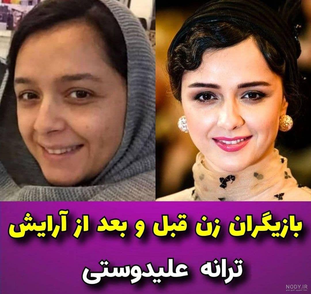 این چند زن زیبا ثابت کردند که بدون آرایش هم می‌توانند کل دنیا را دیوانه و  حیران خودشان کنند! - چی بپوشم