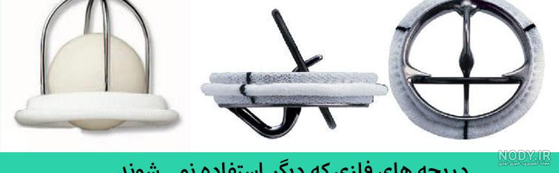 افتادگی دریچه میترال چیست و چگونه درمان می شود؟ – دکترتو افتادگی دریچه میترال چیست و چگونه درمان می شود؟ – دکترتو