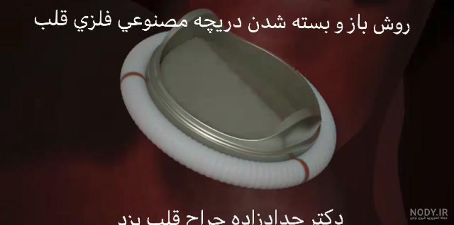 دریچه‌های قلبی