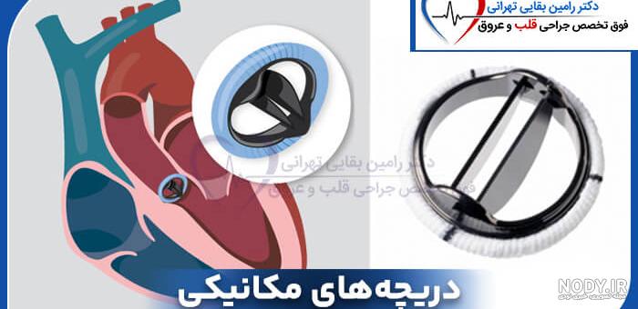 روش باز و بسته شدن دريچه مصنوعي قلب-دكتر حدادزاده روش باز و بسته شدن دريچه مصنوعي قلب-دكتر حدادزاده
