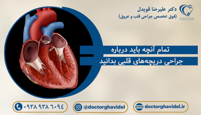 ساخت دریچه های مصنوعی قلب - تمرینو ساخت دریچه های مصنوعی قلب - تمرینو