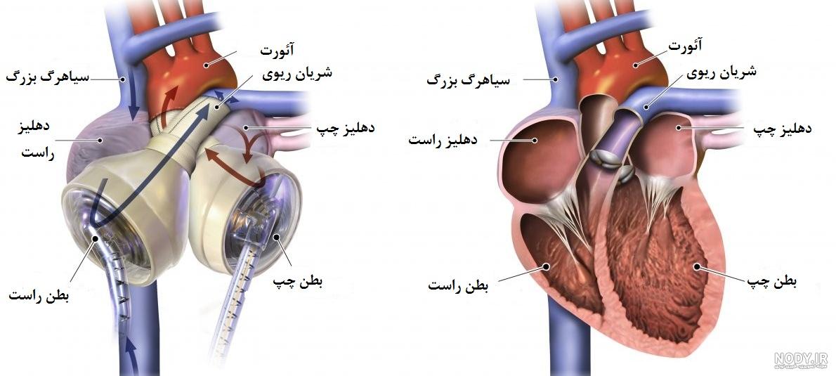 ساخت دریچه‌ مصنوعی قلب با قابلیت خود ترمیمی و ماندگاری بالا - زومیت