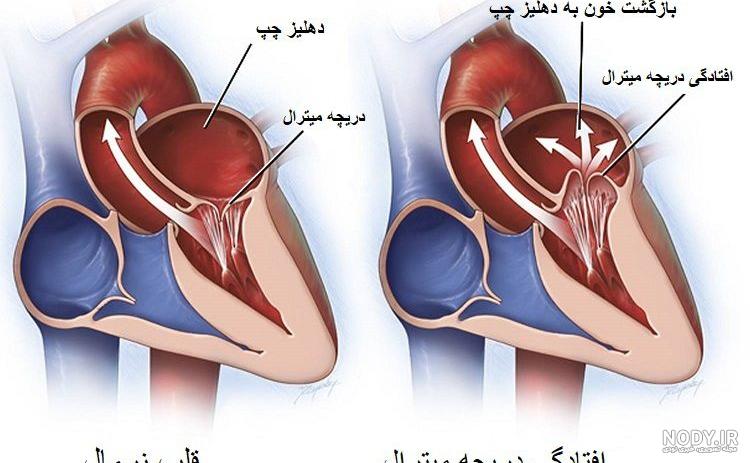 قلب مصنوعی - متخصص قلب و عروق دکتر مهدی کریمی قلب مصنوعی - متخصص قلب و عروق دکتر مهدی کریمی