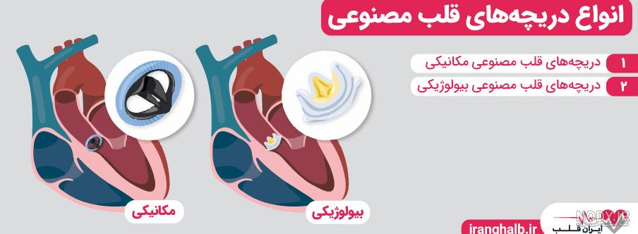 قلب مصنوعی - ویکی‌پدیا، دانشنامهٔ آزاد