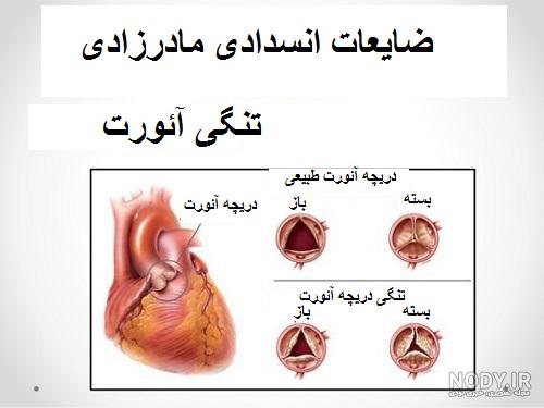 ماجرای کشاورز ایرانی که پمپ قلب مصنوعی ساخت - فردای اقتصاد ماجرای کشاورز ایرانی که پمپ قلب مصنوعی ساخت - فردای اقتصاد