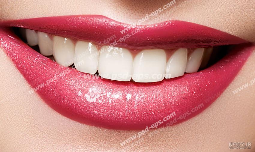 عکس دندان های سفید و لبخند زیبا مدل عکس دندان های سفید و لبخند زیبا مدل