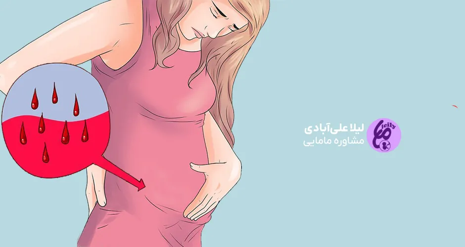 عکس از لکه بینی بارداری