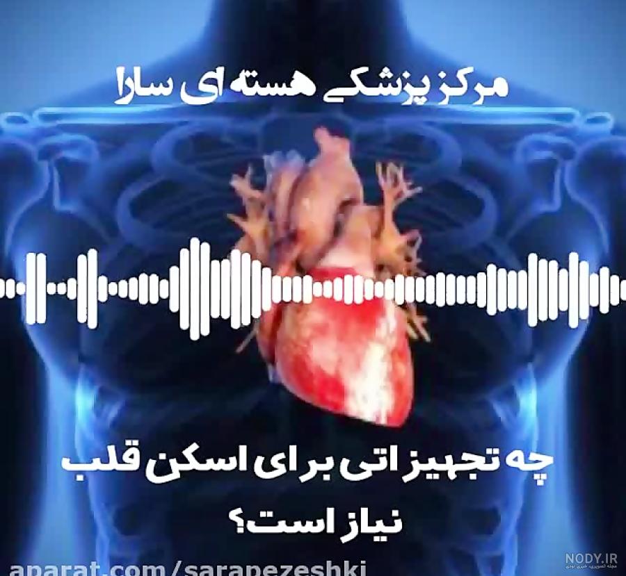 آنژیوگرافی قلب چیست و چه افرادی باید آنژیوگرافی انجام دهند؟ آنژیوگرافی قلب چیست و چه افرادی باید آنژیوگرافی انجام دهند؟