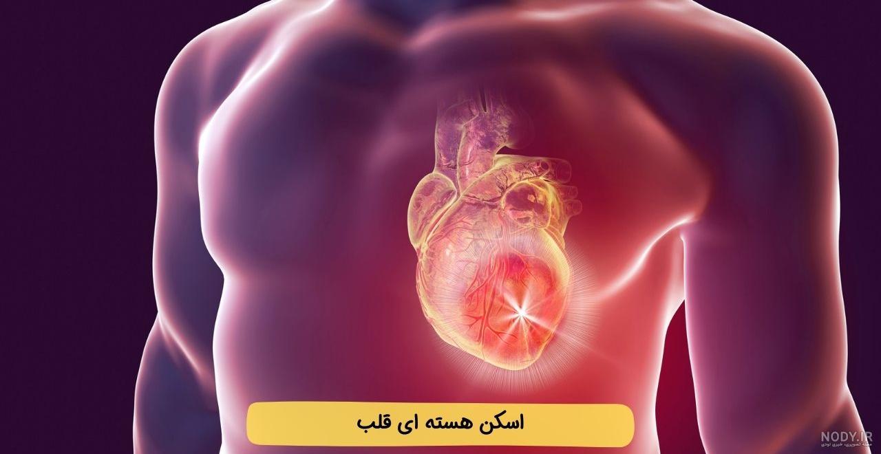 اسکن قلب به روش پزشکی هسته ای ( Cardiac Scan ) و دریافت نوبت اسکن| اسکن طب اسکن قلب به روش پزشکی هسته ای ( Cardiac Scan ) و دریافت نوبت اسکن| اسکن طب