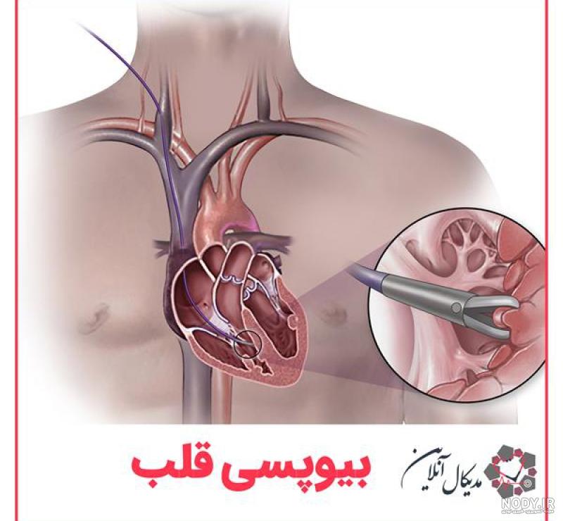 سی تی آنژیوگرافی کرونری چیست؟ - مرکز تصویربرداری دکتر تقی لو سی تی آنژیوگرافی کرونری چیست؟ - مرکز تصویربرداری دکتر تقی لو
