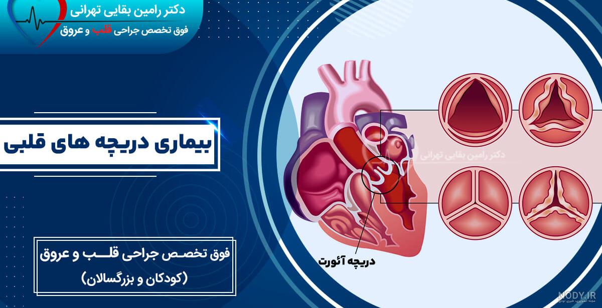 لیست مراکز سی تی آنژیو قلب- لیست مراکز سی تی آنژیو قلب بهمراه تعرفه در سراسر کشور - بازار مدیکال لیست مراکز سی تی آنژیو قلب- لیست مراکز سی تی آنژیو قلب بهمراه تعرفه در سراسر کشور - بازار مدیکال