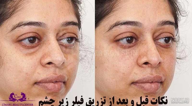 بهترین برند مزوژل|قیمت مزوژل صورت|مزوژل زیر چشم|مزوژل برای لک صورت| مزوژل جالپرو بهترین برند مزوژل|قیمت مزوژل صورت|مزوژل زیر چشم|مزوژل برای لک صورت| مزوژل جالپرو
